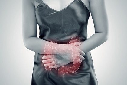 Sindrome-del-colon-irritabile