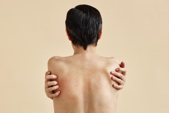 Psoriasi_biorisonanza CIEM System_Bio-T Technologies for Lie Psoriasi_biorisonanza CIEM System_Bio-T Technologies for Lie