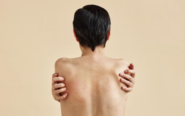 Psoriasi_biorisonanza CIEM System_Bio-T Technologies for Lie